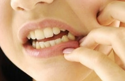 突發(fā)性、自發(fā)性的劇烈牙疼