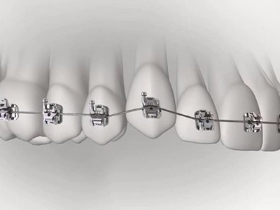 承德市哪家口腔醫(yī)院口腔正畸做得好？惟德口腔醫(yī)院來告訴您